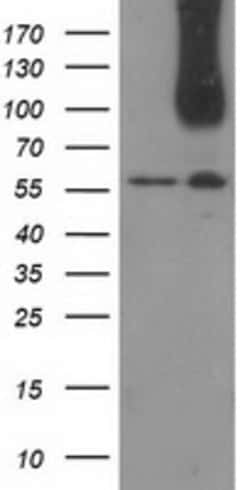 CDCP1 Mouse anti-Human, Clone: OTI2B8, lyophilized, TrueMAB 100 &mu;g;