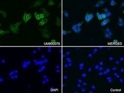 CDH1 Mouse anti-Human, Clone: UMAB184, lyophilized, UltraMAB 100 &mu;g;