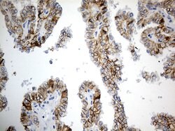 CDH1 Mouse anti-Human, Clone: OTI2D6, lyophilized, TrueMAB 100 &mu;g; Unconjugated:Antibodies,