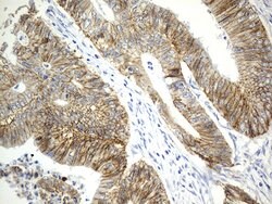 CDH1 Mouse anti-Human, Clone: OTI2D6, lyophilized, TrueMAB 100 &mu;g; Unconjugated:Antibodies,