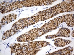 CDH1 Mouse anti-Human, Clone: OTI2D6, lyophilized, TrueMAB 100 &mu;g; Unconjugated:Antibodies,