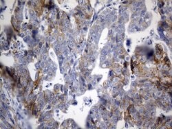 CDH1 Mouse anti-Human, Clone: OTI2D6, lyophilized, TrueMAB 100 &mu;g; Unconjugated:Antibodies,