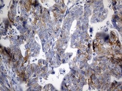 CDH1 Monoclonal Antibody (OTI2D6), TrueMAB , OriGene 100 &mu;L; Unconjugated:Antibodies,