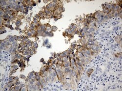CDH1 Mouse anti-Human, Clone: OTI2D6, lyophilized, TrueMAB 100 &mu;g; Unconjugated:Antibodies,