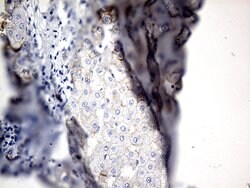 CDH1 Mouse anti-Human, Clone: OTI2D6, lyophilized, TrueMAB 100 &mu;g; Unconjugated:Antibodies,