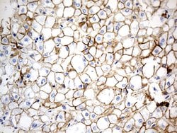 CDH1 Mouse anti-Human, Clone: OTI2D6, lyophilized, TrueMAB 100 &mu;g; Unconjugated:Antibodies,
