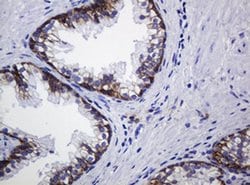 CDH1 Monoclonal Antibody (OTI3E2), TrueMAB , OriGene 100 &mu;L; Unconjugated:Antibodies,