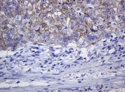 CDH1 Monoclonal Antibody (OTI3E2), TrueMAB , OriGene:Antibodies:Primary