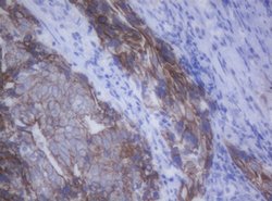 CDH1 Mouse anti-Canine, Human, Clone: OTI1F3, lyophilized, TrueMAB 100