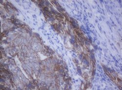 CDH1 Monoclonal Antibody (OTI1F3), TrueMAB , OriGene 100 &mu;L; Unconjugated:Antibodies,