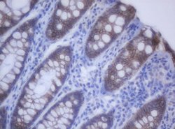 CDH1 Mouse anti-Canine, Human, Clone: OTI1F3, lyophilized, TrueMAB 100