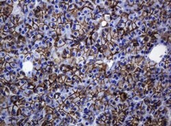 CDH1 Monoclonal Antibody (OTI2F9), TrueMAB , OriGene 100 &mu;L; Unconjugated:Antibodies,