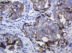 CDH1 Monoclonal Antibody (OTI2F9), TrueMAB , OriGene 100 &mu;L; Unconjugated:Antibodies,