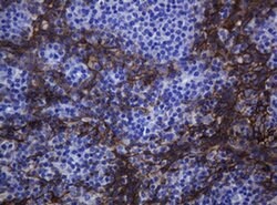 CDH1 Monoclonal Antibody (OTI2F9), TrueMAB , OriGene 100 &mu;L; Unconjugated:Antibodies,