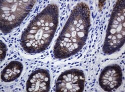 CDH1 Monoclonal Antibody (OTI2F9), TrueMAB , OriGene 100 &mu;L; Unconjugated:Antibodies,