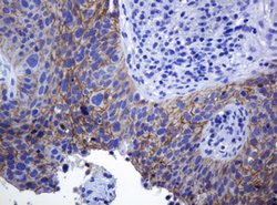 CDH1 Mouse anti-Human, Clone: OTI4F1, lyophilized, TrueMAB 100 &mu;g; Unconjugated:Antibodies,