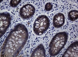 CDH1 Mouse anti-Human, Clone: OTI4F1, lyophilized, TrueMAB 100 &mu;g; Unconjugated:Antibodies,