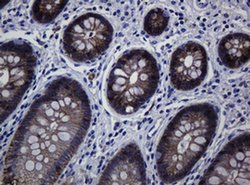 CDH1 Monoclonal Antibody (OTI4F1), TrueMAB , OriGene 100 &mu;L; Unconjugated:Antibodies,