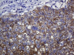 CDH1 Mouse anti-Human, Clone: OTI4F1, lyophilized, TrueMAB 100 &mu;g; Unconjugated:Antibodies,