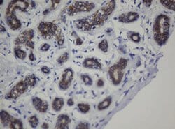 CDH1 Monoclonal Antibody (OTI1G1), TrueMAB , OriGene 100 &mu;L; Unconjugated:Antibodies,