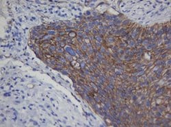 CDH1 Monoclonal Antibody (OTI1G1), TrueMAB , OriGene:Antibodies:Primary