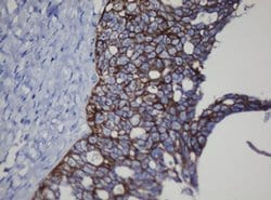 CDH1 Monoclonal Antibody (OTI1G1), TrueMAB , OriGene 100 &mu;L; Unconjugated:Antibodies,
