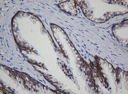 CDH1 Monoclonal Antibody (OTI1G1), TrueMAB , OriGene 100 &mu;L; Unconjugated:Antibodies,