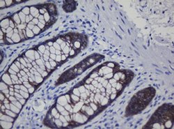 CDH1 Monoclonal Antibody (OTI1G1), TrueMAB , OriGene:Antibodies:Primary