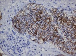 CDH1 Monoclonal Antibody (OTI1G1), TrueMAB , OriGene 100 &mu;L; Unconjugated:Antibodies,