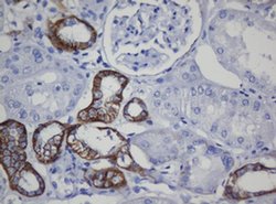 CDH1 Monoclonal Antibody (OTI1G1), TrueMAB , OriGene 100 &mu;L; Unconjugated:Antibodies,