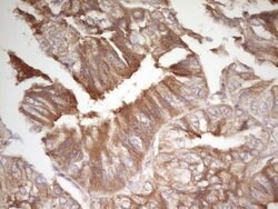 CDH1 Monoclonal Antibody (OTI3C11), TrueMAB , OriGene 100 &mu;L; Unconjugated:Antibodies,