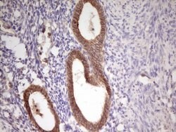 CDH1 Monoclonal Antibody (OTI3C11), TrueMAB , OriGene 100 &mu;L; Unconjugated:Antibodies,
