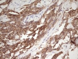 CDH1 Monoclonal Antibody (OTI3C11), TrueMAB , OriGene 100 &mu;L; Unconjugated:Antibodies,