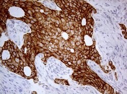 CDH1 Monoclonal Antibody (OTI3C11), TrueMAB , OriGene 100 &mu;L; Unconjugated:Antibodies,