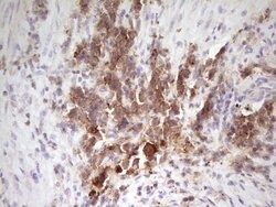 CDH1 Monoclonal Antibody (OTI3C11), TrueMAB , OriGene 100 &mu;L; Unconjugated:Antibodies,