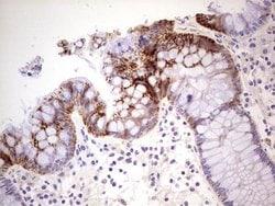 CDH1 Monoclonal Antibody (OTI3C11), TrueMAB , OriGene 100 &mu;L; Unconjugated:Antibodies,