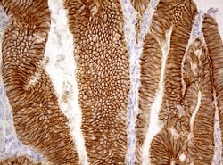 CDH1 Monoclonal Antibody (OTI3C11), TrueMAB , OriGene 100 &mu;L; Unconjugated:Antibodies,