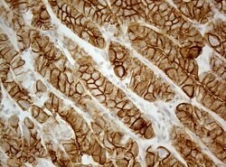 CDH1 Monoclonal Antibody (OTI3C11), TrueMAB , OriGene 100 &mu;L; Unconjugated:Antibodies,