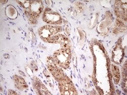 CDH1 Monoclonal Antibody (OTI3C11), TrueMAB , OriGene 100 &mu;L; Unconjugated:Antibodies,