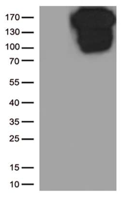 CDH1 Mouse anti-Human, Clone: OTI2D6, lyophilized, TrueMAB 100 &mu;g; Unconjugated:Antibodies,