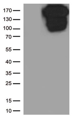 CDH1 Monoclonal Antibody (OTI2D6), TrueMAB , OriGene 100 &mu;L; Unconjugated:Antibodies,