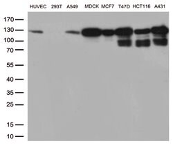 CDH1 Mouse anti-Human, Clone: OTI2D6, lyophilized, TrueMAB 100 &mu;g; Unconjugated:Antibodies,