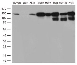 CDH1 Monoclonal Antibody (OTI2D6), TrueMAB , OriGene 100 &mu;L; Unconjugated:Antibodies,
