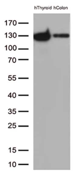 CDH1 Mouse anti-Human, Clone: OTI2D6, lyophilized, TrueMAB 100 &mu;g; Unconjugated:Antibodies,