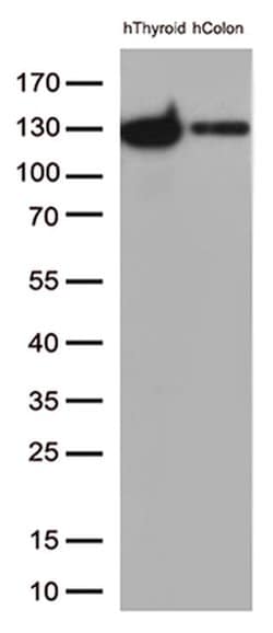 CDH1 Monoclonal Antibody (OTI2D6), TrueMAB , OriGene 100 &mu;L; Unconjugated:Antibodies,