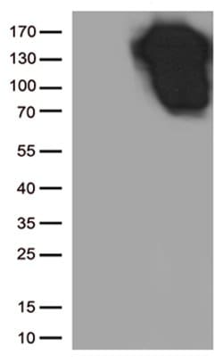 CDH1 Mouse anti-Human, Clone: OTI3E2, lyophilized, TrueMAB 100 &mu;g; Unconjugated:Antibodies,