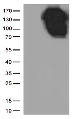 CDH1 Mouse anti-Canine, Human, Clone: OTI1F3, lyophilized, TrueMAB 100