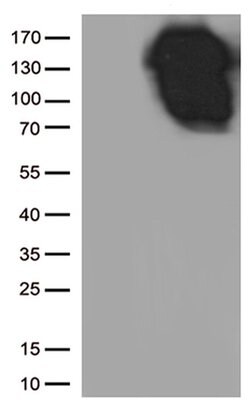 CDH1 Monoclonal Antibody (OTI1F3), TrueMAB , OriGene 100 &mu;L; Unconjugated:Antibodies,