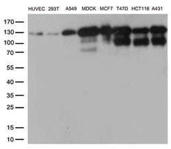 CDH1 Monoclonal Antibody (OTI1F3), TrueMAB , OriGene 100 &mu;L; Unconjugated:Antibodies,