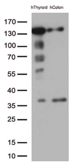 CDH1 Mouse anti-Canine, Human, Clone: OTI1F3, lyophilized, TrueMAB 100